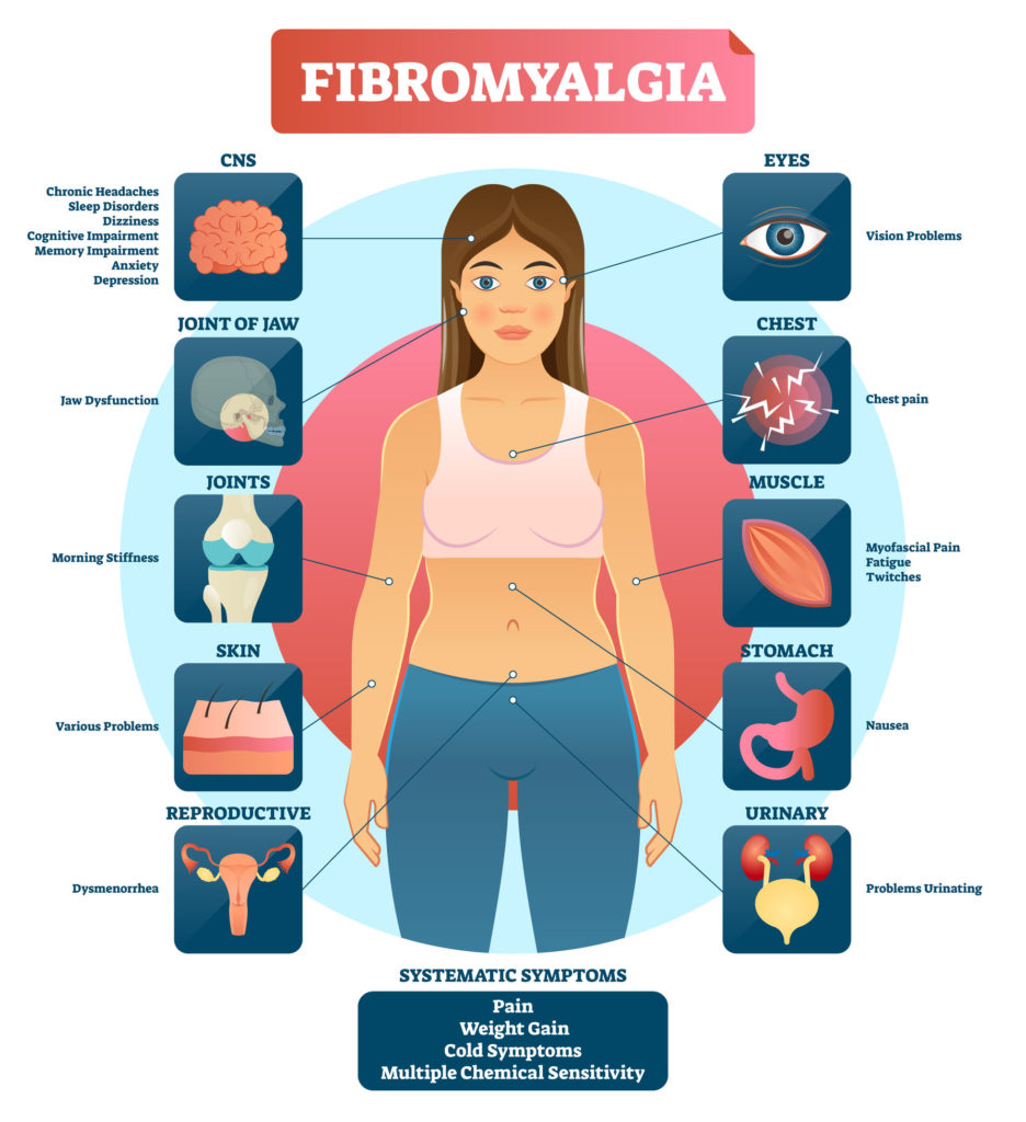 What Is Fibromyalgia? | Open Medicine Foundation