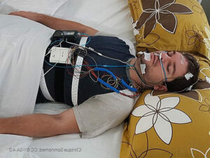 Woman undergoing a sleep test. 