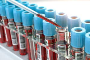 Closeup of a pipette adding red liquid to a test tube. 