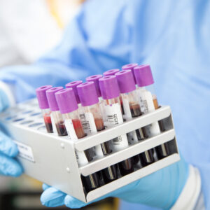 The image shows a gloved hand holding a metal rack filled with blood collection tubes. The tubes are labeled with barcodes and contain varying levels of blood. The person handling the samples is wearing a light blue protective gown and blue gloves.