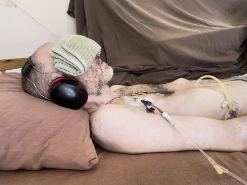 The image shows Whitney laying in a bed on a brown pillow with a towel over his eyes. On the right side of his chest, he has a medical tube attached.